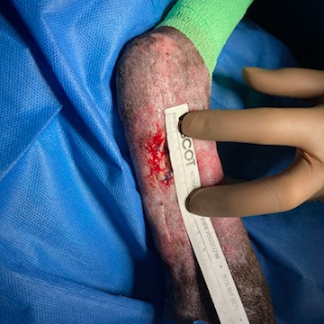 Vetlen case study Torn Left Hind Achilles image - 6