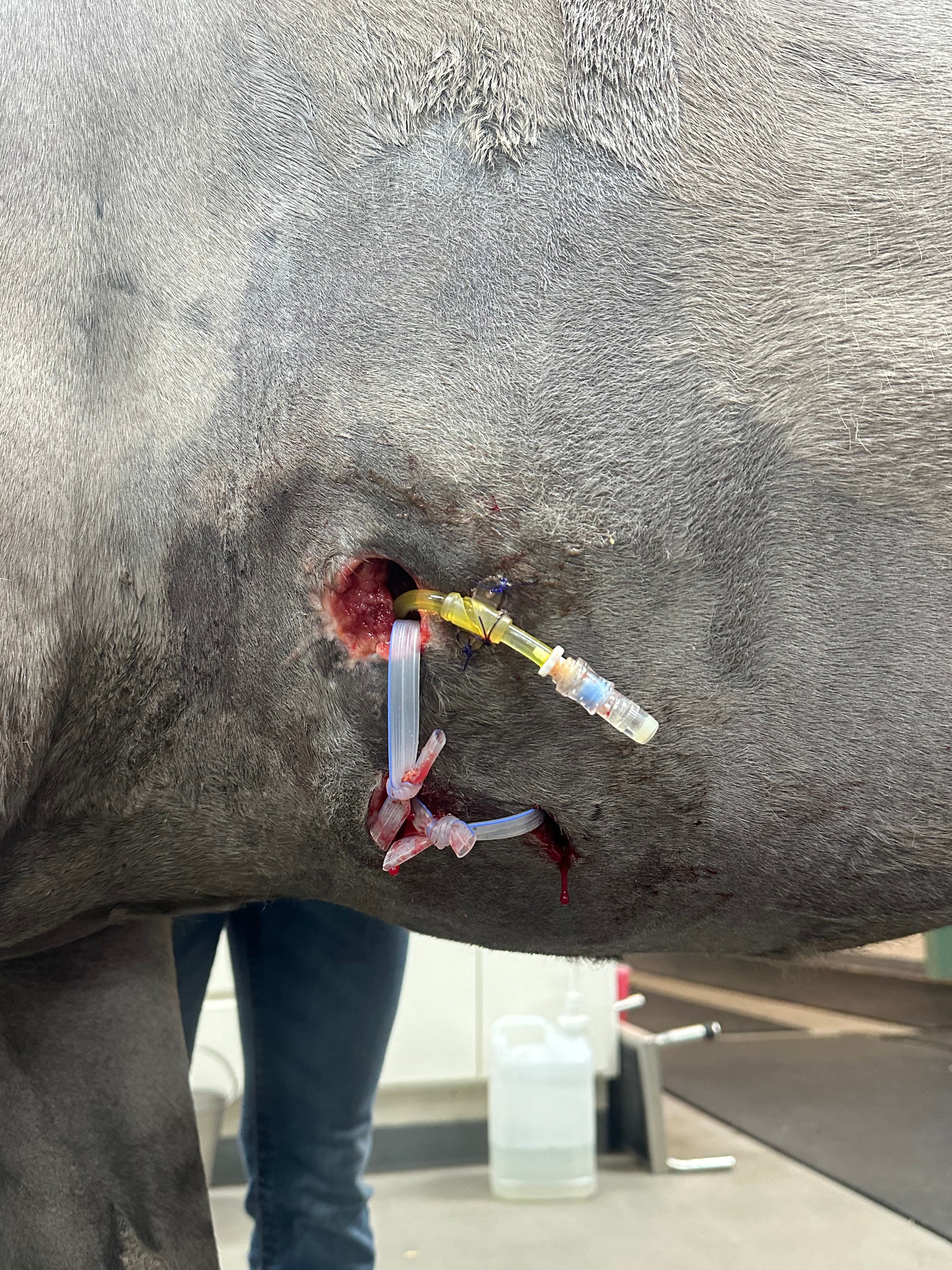 Vetlen case study Thoracic Puncture Wound Leading to Splenic Abscess image - 7