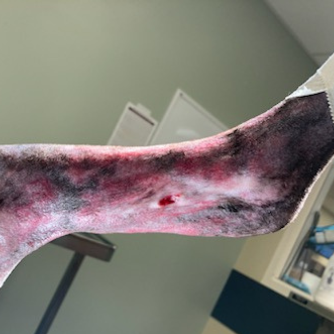 Vetlen case study Torn Left Hind Achilles image - 6