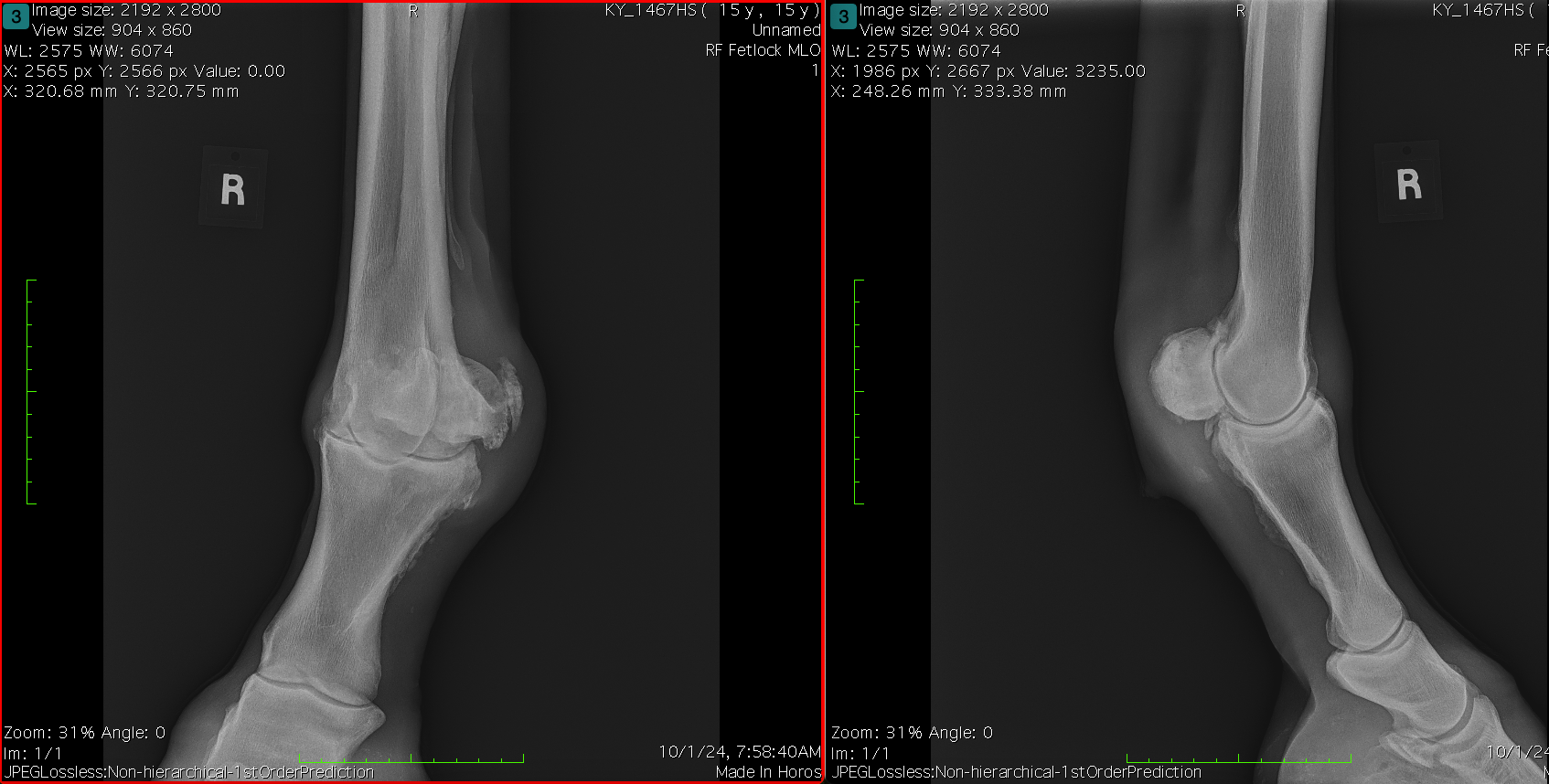 Vetlen case study Fetlock Arthrodesis Due To Degenerative Arthritis image - 3