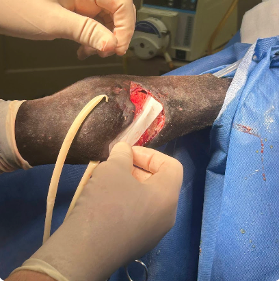 Vetlen case study Right Hind Dorsal Fetlock Laceration and Trauma image - 11