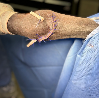 Vetlen case study Right Hind Dorsal Fetlock Laceration and Trauma image - 11