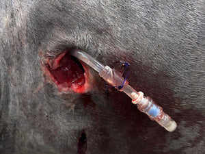 Vetlen case study image - Thoracic Puncture Wound Leading to Splenic Abscess
