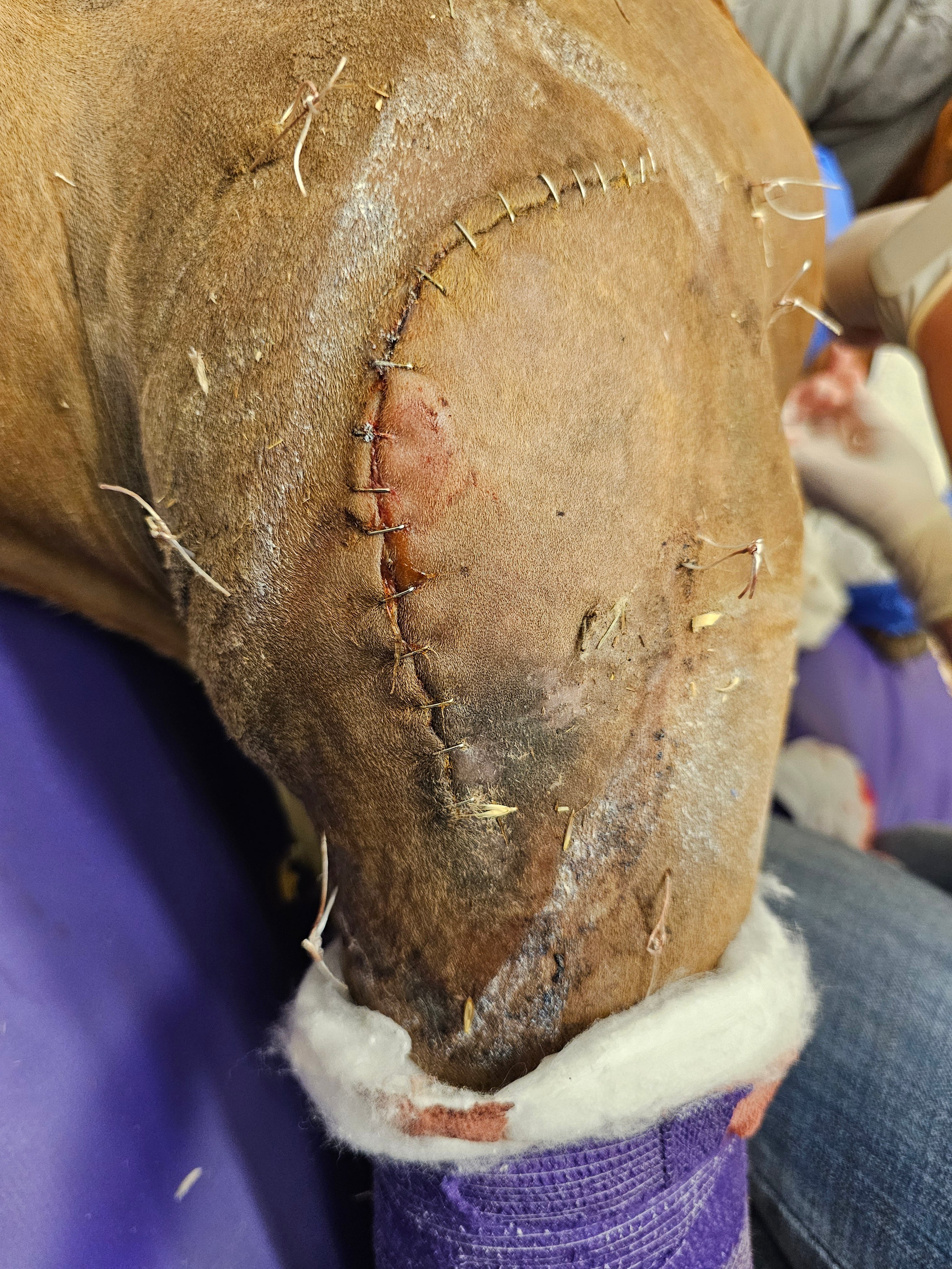 Vetlen case study Type I Olecranon Fracture image - 1