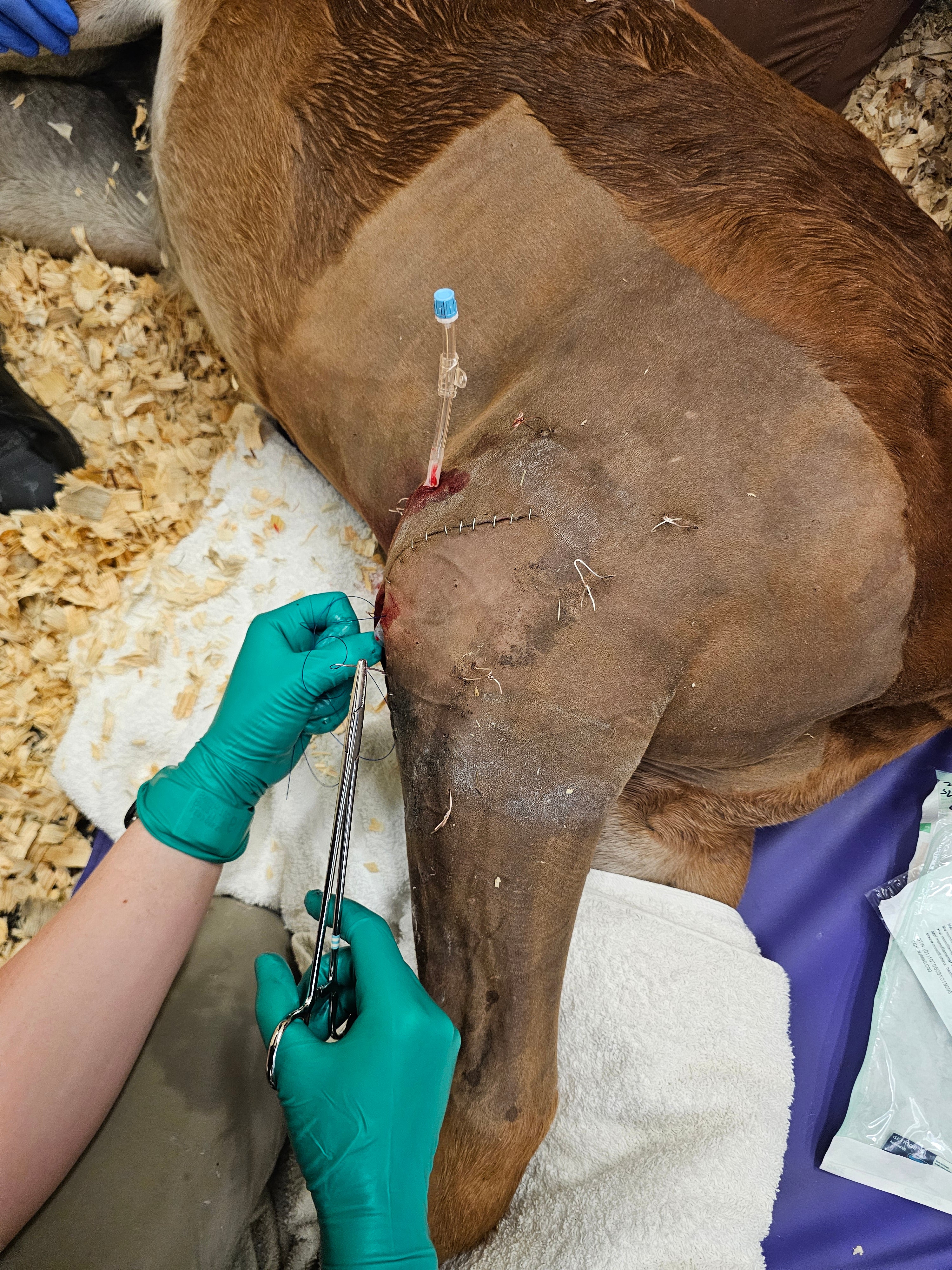 Vetlen case study Type I Olecranon Fracture image - 1