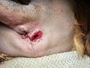 Vetlen case study image - Chronic Multi-drug Resistant Wound (> 1 year) Lateral to Anus