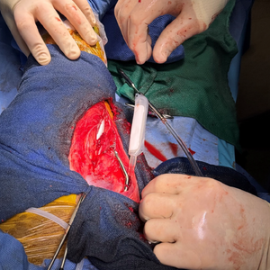 Vetlen case study image - Proximal Ulnar Physeal Fracture 