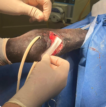 Vetlen case study Right Hind Dorsal Fetlock Laceration and Trauma image - 1