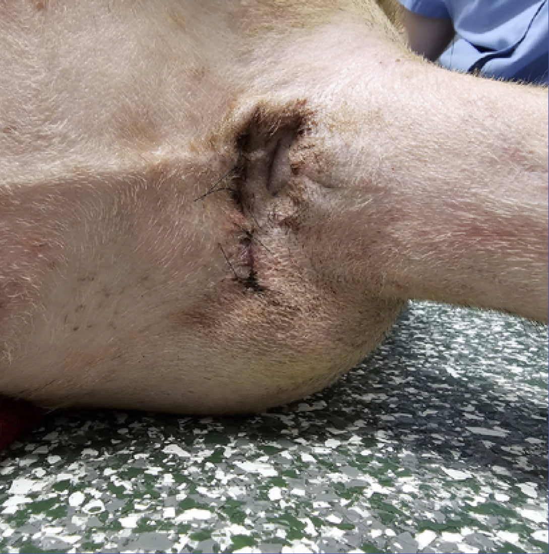 Vetlen case study Chronic Multi-drug Resistant Wound (> 1 year) Lateral to Anus image - 2